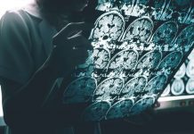 Early signs of Alzheimer’s disease