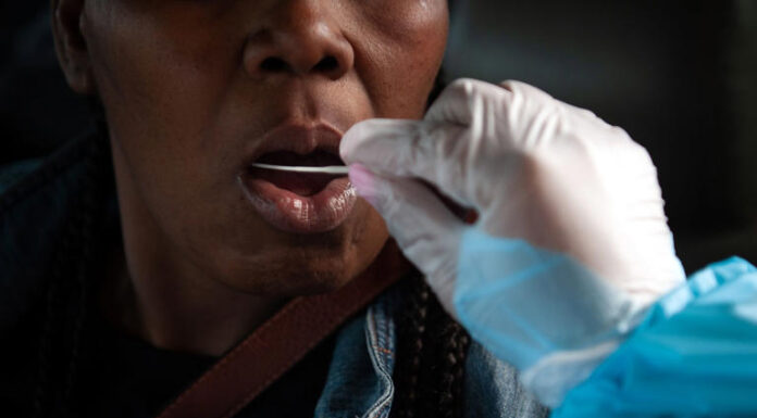 Covid’s Harmful Effects on the Brain Reverberate Years Later